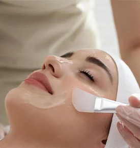 Chemical Peel